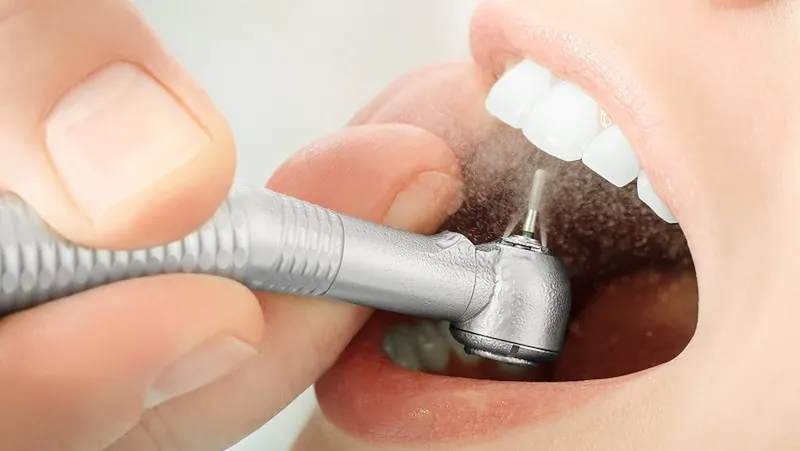 Mài đều răng có đau không