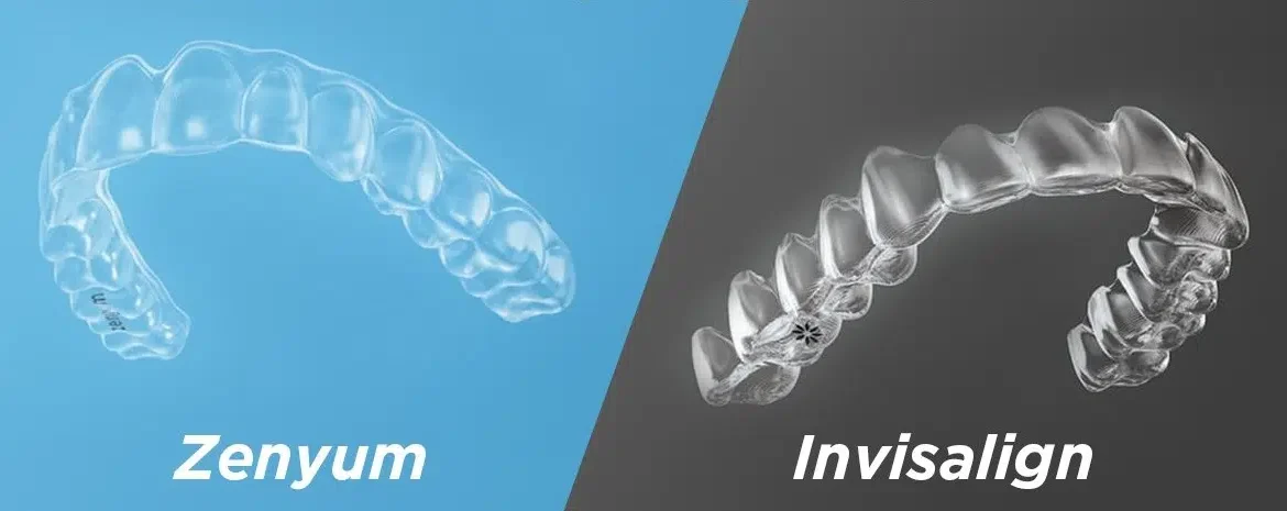 So sánh chi phí và thời gian điều trị