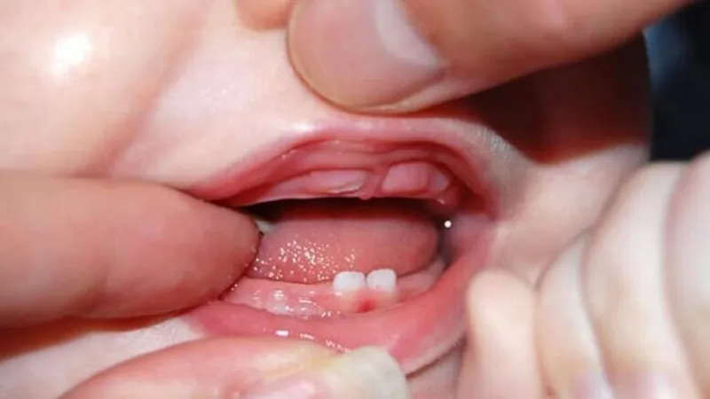 cách để răng mọc nhanh
