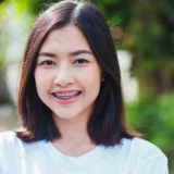 niềng răng có được dùng bảo hiểm y tế
